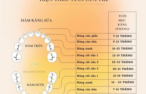 Những điều mẹ cần biết khi trẻ mọc răng hàm